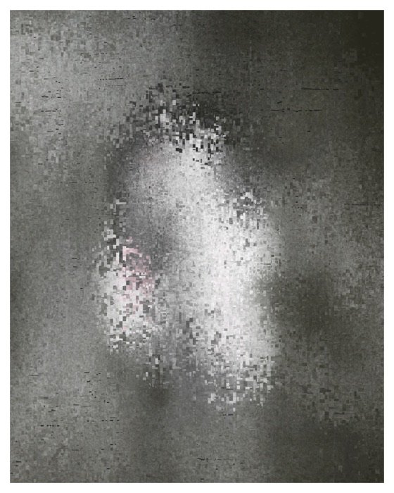Foggy Window, image 2